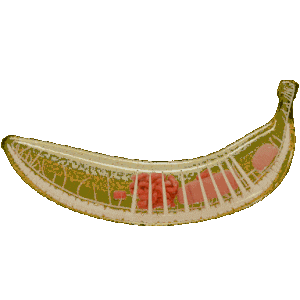 X-raynana